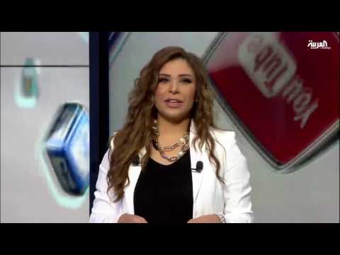 صور تكشف علامات الضرب على وجه زوجة جوني ديب