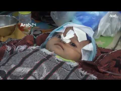 بالفيديو أوضاع معيشية صعبة في الحديدة