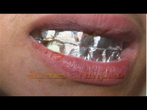 فيديو طريقة سحرية تمنحك أسنانا بيضاء