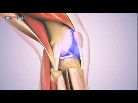 الفيديو اكتشاف وجود فوائد كبيرة للصيام لمرضى الروماتيزم