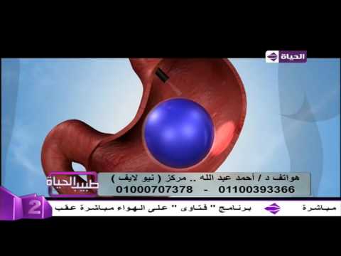 تعرف على عملية بلون المعدة لإنقاص الوزن