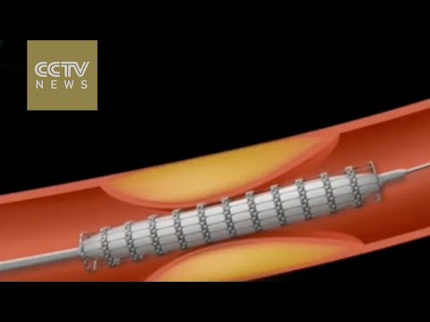 بالفيديو  علماء كوريا الجنوبية يصنعون إنسانًا آليًا لقتل مرض السرطان