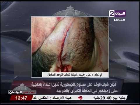 شاهد لجان شباب الوفد تدين إعتداء بلطجية على زميلهم في المحلة
