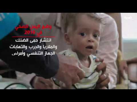 شاهد تحذيرات دولية من انهيار الأوضاع الصحية في اليمن