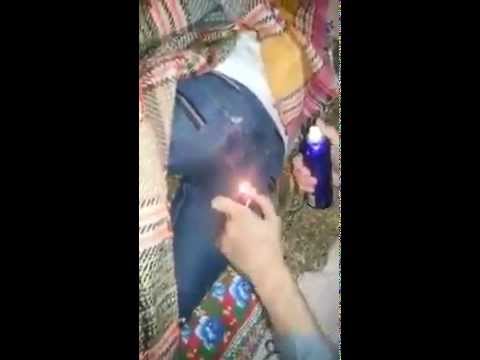 طالبان يشعلان النار في زميلهما أثناء نومه