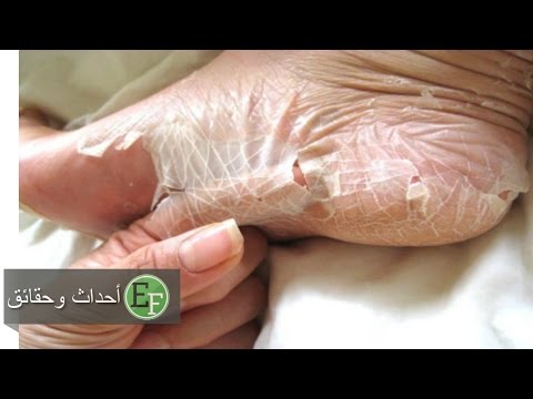 شاهد 5 أشياء ستدهشك حول قدرتك الجسدية يجب عليك معرفتها