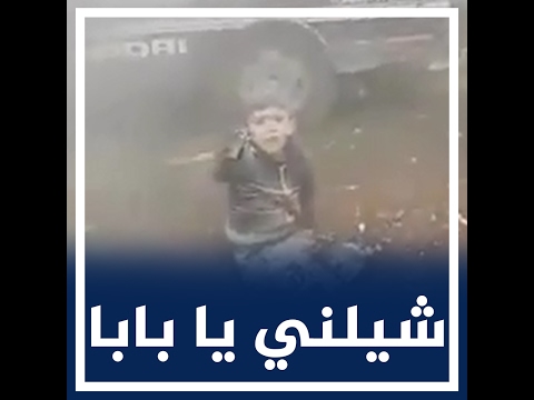 شاهد صرخة طفل سوري بتر القصف ساقيه