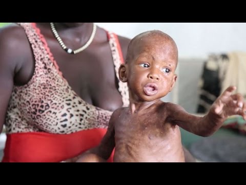 جنوب السودان ونزوح متواصل ومجاعة تتفاقم