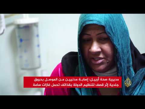 إصابة مدنيين من الموصل بحروق إثر قصف داعش