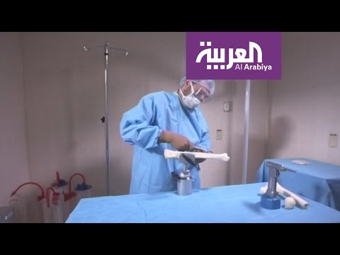 بالفيديو دعوات جديدة لتعزيز ثقافة التبرّع بالأعضاء بين السعوديين