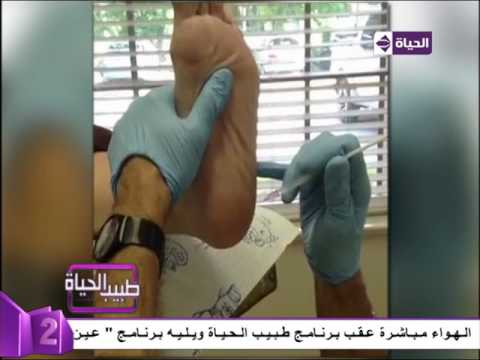  بالفيديو كيفية علاج الشوكة العظمية للمريض