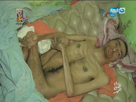 شاهد جنّ يحوّل شقيقين إلى شكل مخيف يعزلهما عن المجتمع