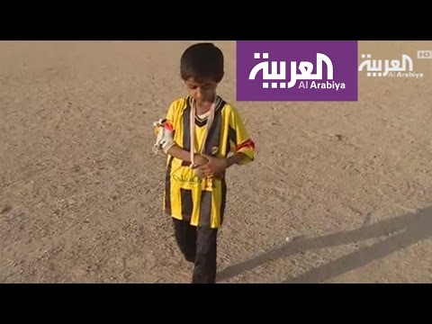 شاهد محمد نور اليمني طفل من ضحايا الألغام