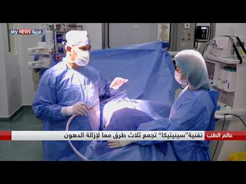 ابتكار تقنية جديدة وآمنة لشفط الدهون