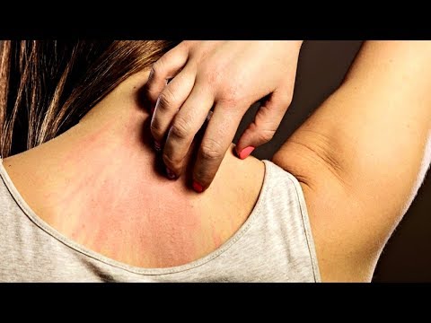 شاهد 8علامات تدل على الإصابة بالسرطان