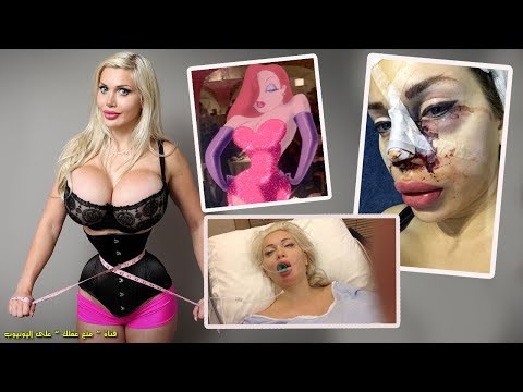 فتاة تُجري 20 عملية تجميل لتشبه شخصية كرتونية