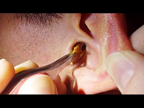 تعرف على طريقة رائعة لإزالة الشمع بسهولة