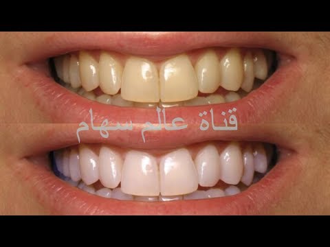 شاهد وصفة أكثر من رائعة لتبييض الأسنان في دقيقتين