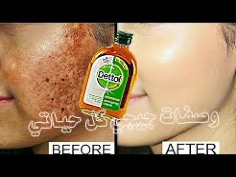 شاهد قطرتان مع اللبن وكوني بيضاء البشرة