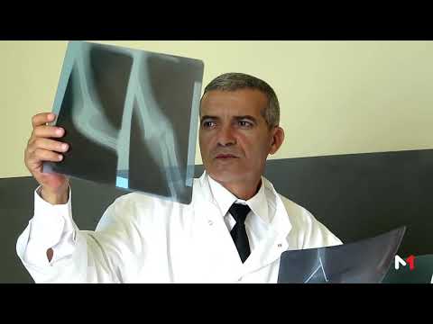 طريقة الفحص الطبي للمجندين في إطار الخدمة العسكرية في المغرب