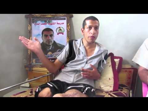 شاهد أحد جرحى عدوان غزة يروي مأساته