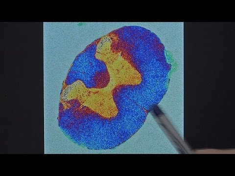 بالفيديو ماسح بالرنين المغناطيسي للكشف عن الأمراض مبكرًا