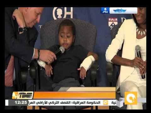 بالفيديو طفل يبلغ ثمانية أعوام يخضع لعملية جراحية ناجحة