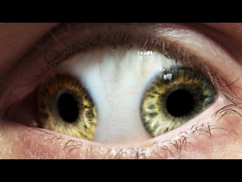 شاهد اغرب الأمراض التي أصابت بعض الناس وحيرت العلم