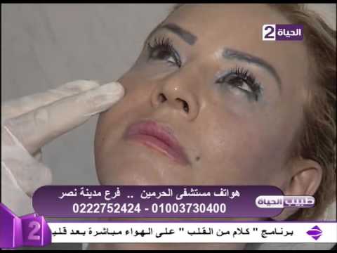 شاهد استخدام البوتكس والفيلر لإعادة نضارة البشرة