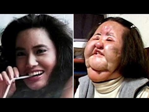 شاهد 10 حالات جراحة للتجميل