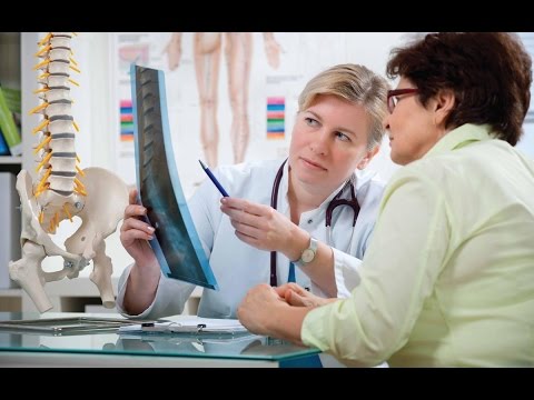 شاهد 200 مليون شخص يعانون من هشاشة العظام