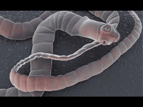 وفاة رجل بسبب إصابة دودة بالسرطان داخل جسمه