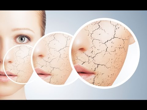 بالفيديو 3 وصفات سحرية للتخلص من البثور في الوجه