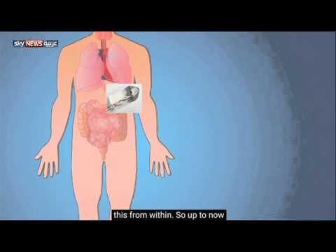 شاهد كبسولة ذكية لقياس نبضات القلب