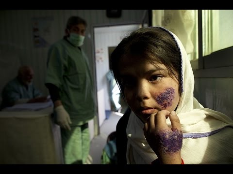 شاهد انهيار النظام الصحي وجثث القتلى في الطرقات