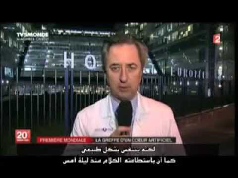 عامان فقط على أول عملية زراعة قلب صناعى بالكامل فى التاريخ