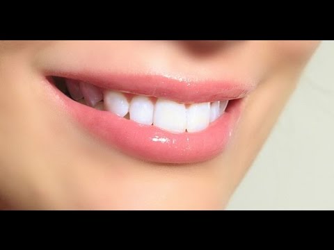 فيديو ستة أسباب غير مألوفة تؤدي إلى إصفرار الأسنان