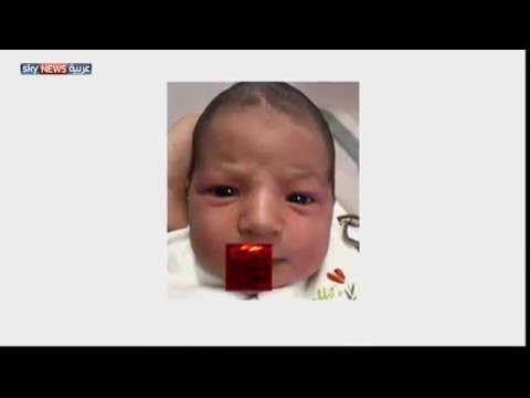 شاهد تطبيق يحلل نبضات قلب الأطفال في الامارات