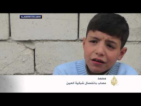 حرب سورية تسبب عاهات مستديمة للأطفال