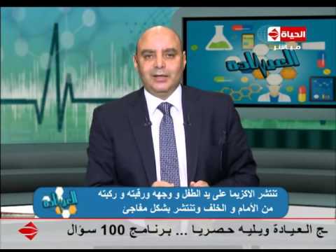 الفرق بين الحصبة والحصبة الألمانية وأهمية التطعيم