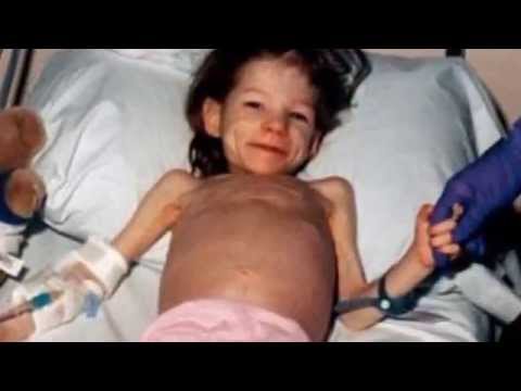 حالات إنسانية استطاعت التعايش