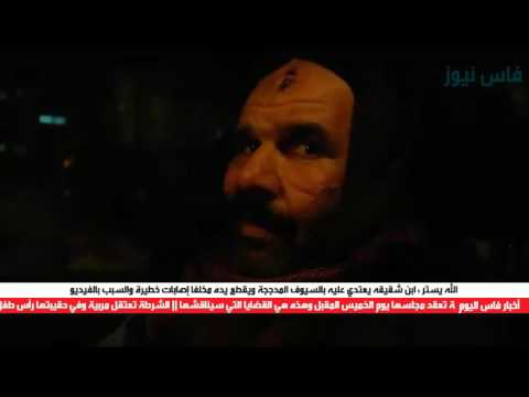 ابن شقيقه يعتدي عليه بالسيوف المدججة ويقطع يده
