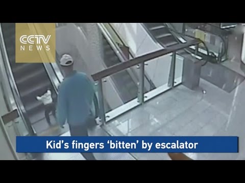 شاهد سلم كهربائي يقطع أصابع رضيعة صينية